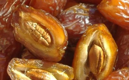 Böyrək daşından əziyyət çəkənlərin diqqətinə