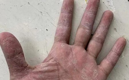 Ovucda üzə çıxan xəstəlik əlaməti