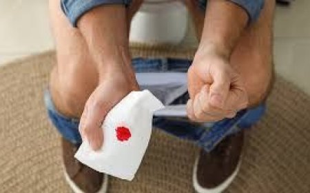 Babasil və bağırsaq xərçəngi zamanı qanamanın fərqi