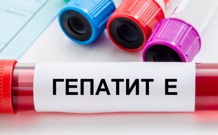 Hepatit E siçovullar arasında yayılır