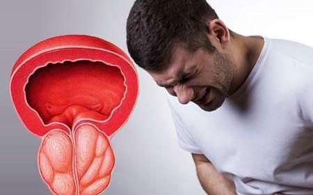 Hansı yaşdan sonra prostat xərçəngindən yoxlanmaq lazımdır?