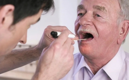 Ağız xərçəngi nədir? Ağız xərçənginin simptomları və müalicəsi