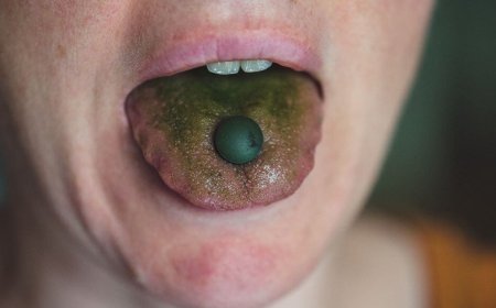 Dil üstünün yaşıl rəngdə olmasının 7 səbəbi