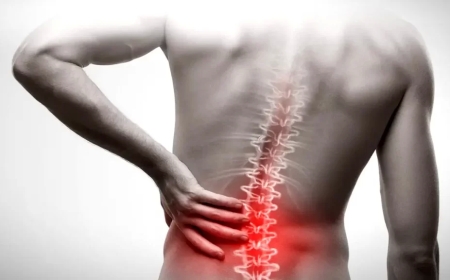 Bel sürüşməsi xəstəliyi nədir?