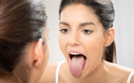 Dil xərçəngi nədir?