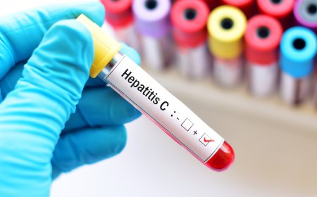 Hepatit C nədir?