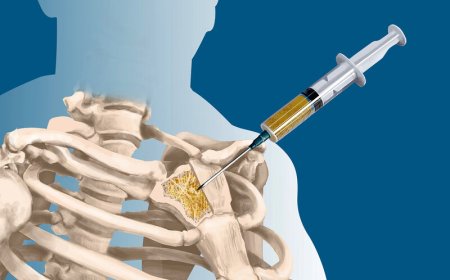 Sümük iliyi xərçəngi nədir?