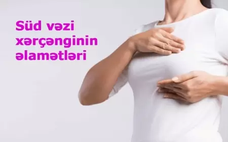 Süd vəzi xərçənginin əlamətləri (döş xərçəngi)