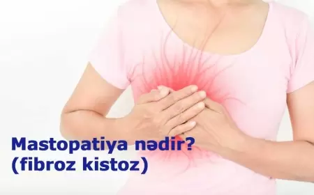 Mastopatiya nədir (fibroz kistoz)