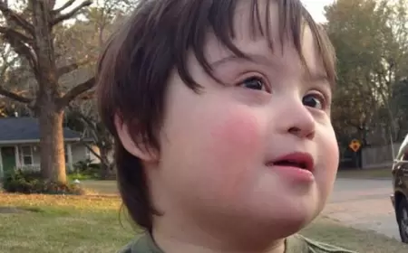 Hamiləlik dövründə Daun sindromuna görə müayinə