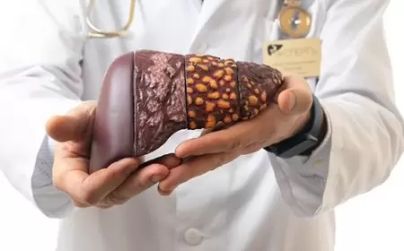 Qaraciyər yağlanmasından qurtulmağın yolları