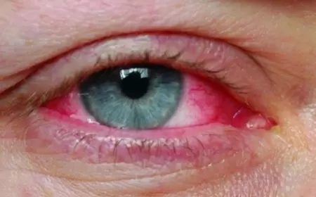 Gözdə iltihab yaradan səbəblər