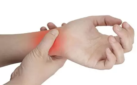 Biləkdə ağrı. Karpal tunel sindromu