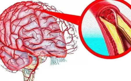 Qan damarları elastikləşir, başgicəllənmə yox olur - Bu resepti SINAYIN!