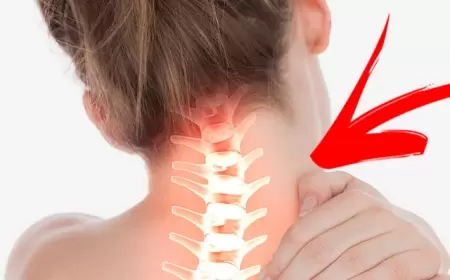 Osteoxondroz üçün kompres - TƏBİİ ÜSUL