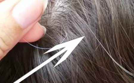 Saçımız niyə tez ağarır? Səbəblər