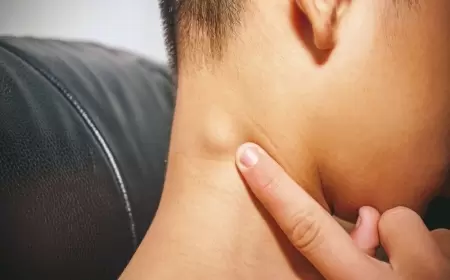 Limfa düyünləri – böyüməsi və çarələri