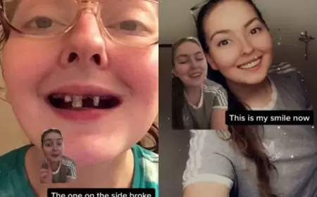 10 il qazlı su içdi, dişləri çürüyüb töküldü (FOTO)