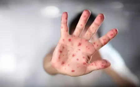 Meymunçiçəyini kimlər daha AĞIR KEÇİRİR?