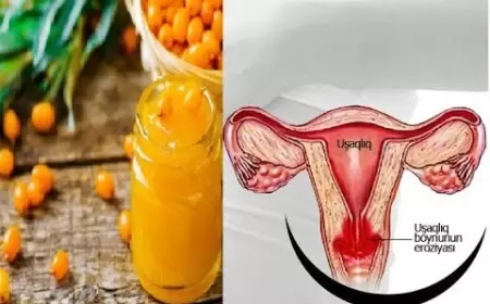 Uşaqlıq boynu eroziyasının TƏBİİ MÜALİCƏSİ