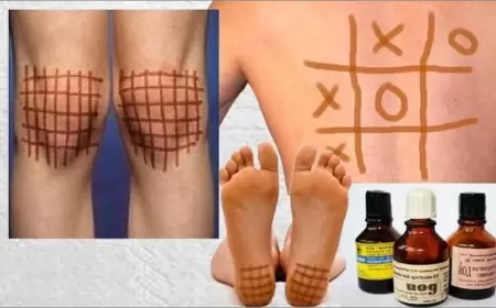 Yod kletkası hansı xəstəliklərə FAYDALIDIR?