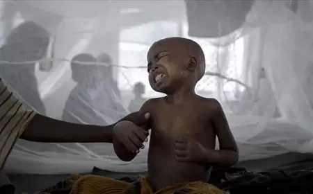 Vəba epidemiyası: Ölənlərin sayı 315-ə yüksəldi