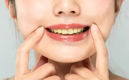 Dişlərinizdə ən kiçik sararma belə buraxmayacaq ÜSULLAR