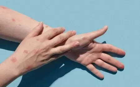 Bu ölkədə meymunçiçəyinin yeni növü aşkarlandı