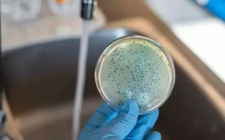 Vəba sürətlə yayılır - Yüzlərlə ölü, minlərlə yoluxan var