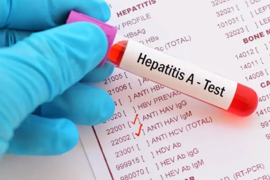 Azərbaycanda hepatit daşıyıcıları əsgərliyə aparılmır? - AÇIQLAMA