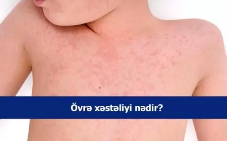 Övrə xəstəliyi nədir?