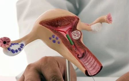 Menstruasiya pozulmaları (qanama və menstruasiya ağrıları)