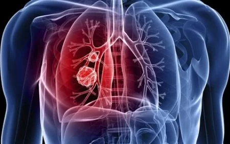 ŞOK! Xərçəngə meydan oxuyan meyvə: hər kəs yeyir, lakin bu faydasını bilən yoxdur