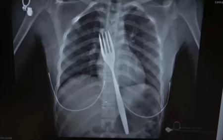 18 yaşlı qız çəngəl uddu