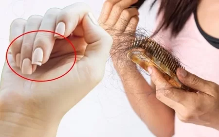 Bədəndə çatışmazlığı sizi xəstələndirir: Saç tökülməsi, kövrək dırnaqlar..