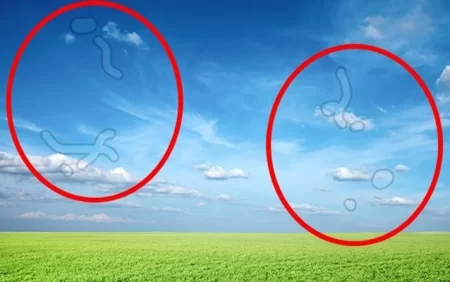 Gözlərin qabağında uçuşan nöqtə və saplar... - Narahat olmağa dəyərmi?