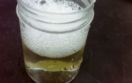 Sidikdə köpüyün olması təhlükəlidirmi?