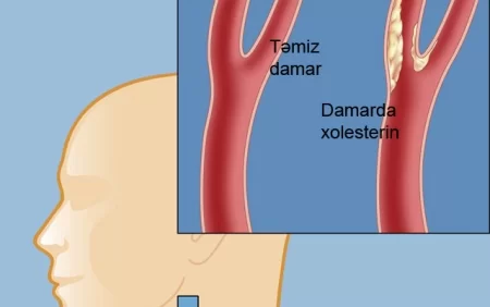 Xolesterinin və yüksək təzyiqin birinci düşməni -  Hər gün 1 ovuc yeyin!