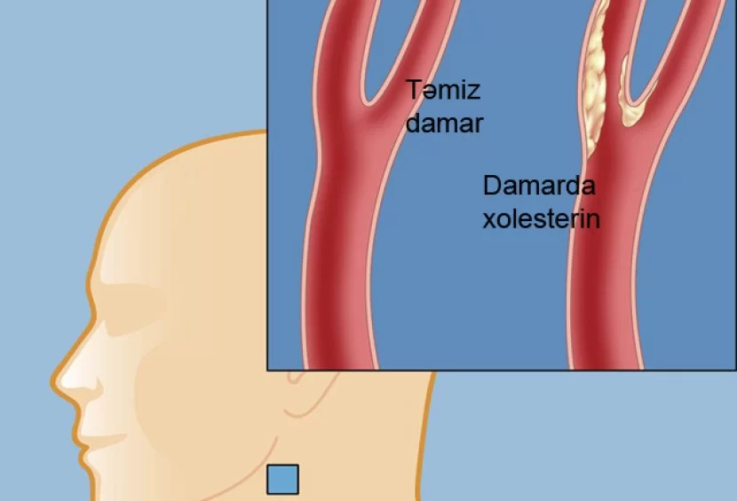 Xolesterinin və yüksək təzyiqin birinci düşməni -  Hər gün 1 ovuc yeyin!