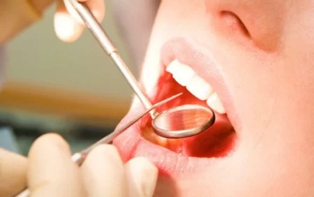 Diş təmizliyi ilə Altsheymer xəstəliyi arasında əlaqə aşkarlandı