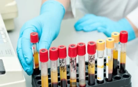 Analizlərin düzgün verilməsi qaydaları. Bunu hamı bilməlidir!