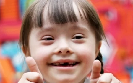 Daun sindromu müalicəsində inqilab - Yeni dərman icad edildi