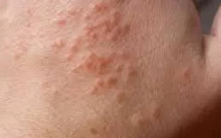 Öpüşməyi, qucaqlaşmağı yığışdırın! - Həkimdən xəbərdarlıq