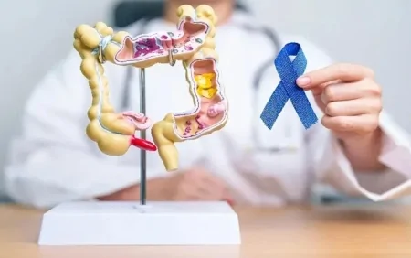 Yoğun bağırsaq xərçəngi artır: Mütəxəssislər “qatıq” tövsiyə edir