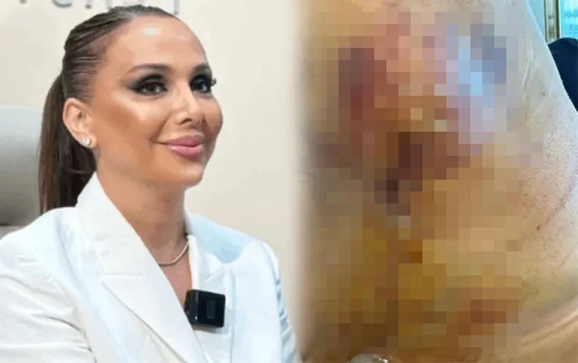 “Həkim məni 3 dəfə əməliyyat edib pis vəziyyətə qoydu”