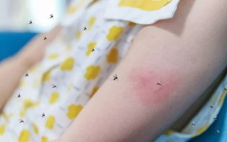 Ağcaqanadlar hansı xəstəlikləri qanla yaya bilər?