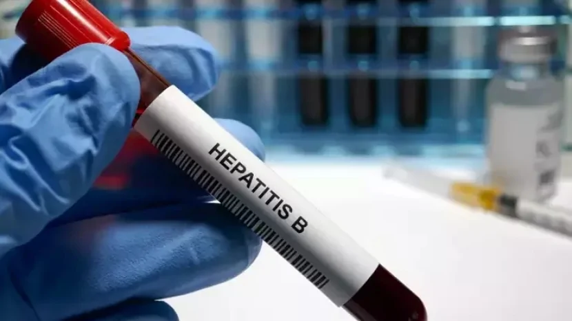 Hepatit B-nin əlamətləri və müalicə yolları - VACİB AÇIQLAMA