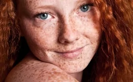 Çilləri belə yox edin