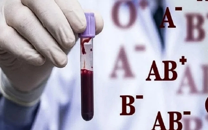 Bu qan qrupu olanlar diqqətli olsun: Beyin insultu riski daha yüksəkdir